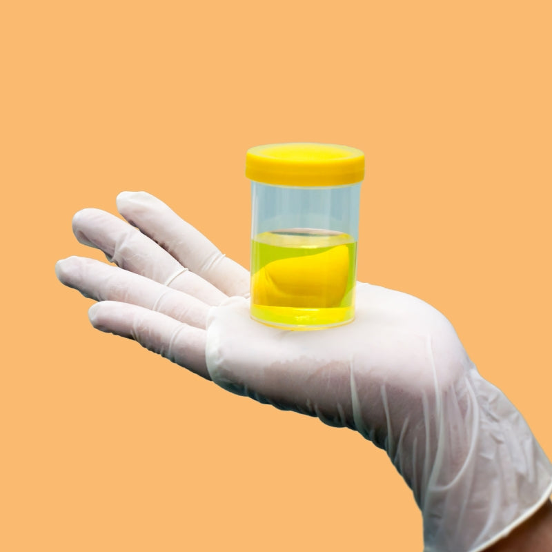 Bladder Care in Labour